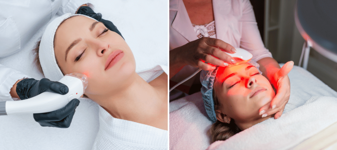 Acne 101 Understanding Different Types, Causes, and Effective Treatments (3)