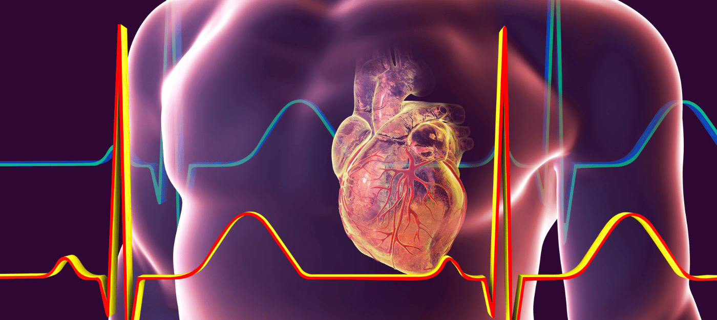 Cardiovascular