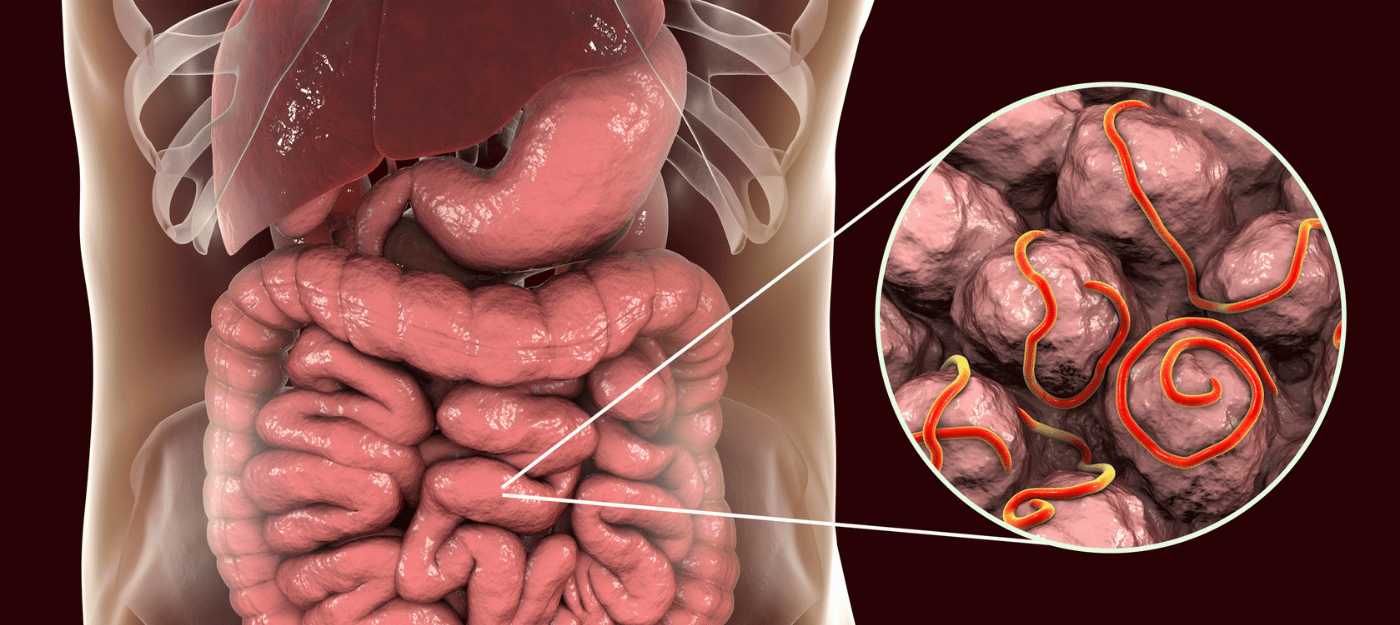 The Role of the GI Tract