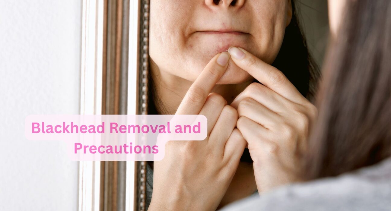 Blackhead Removal and Precautions