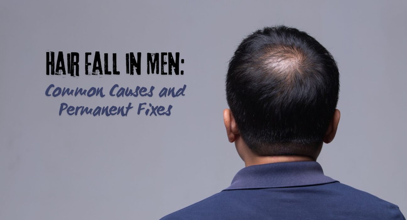 Hair Fall in men