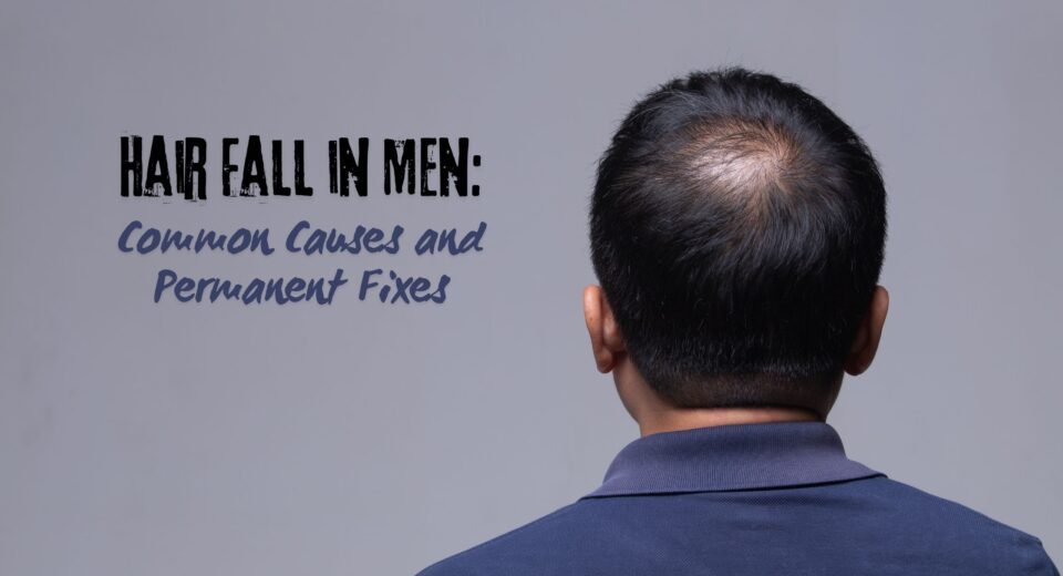 Hair Fall in men