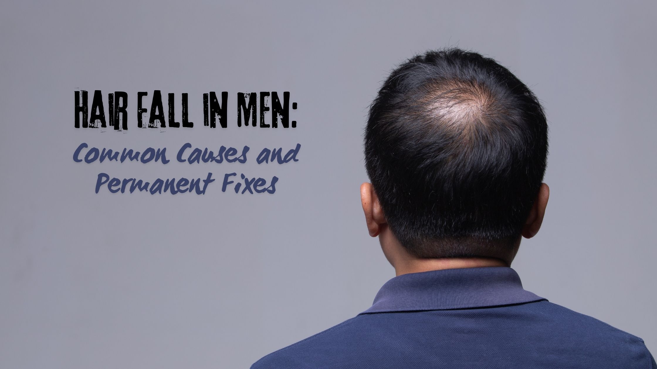 Hair Fall in men