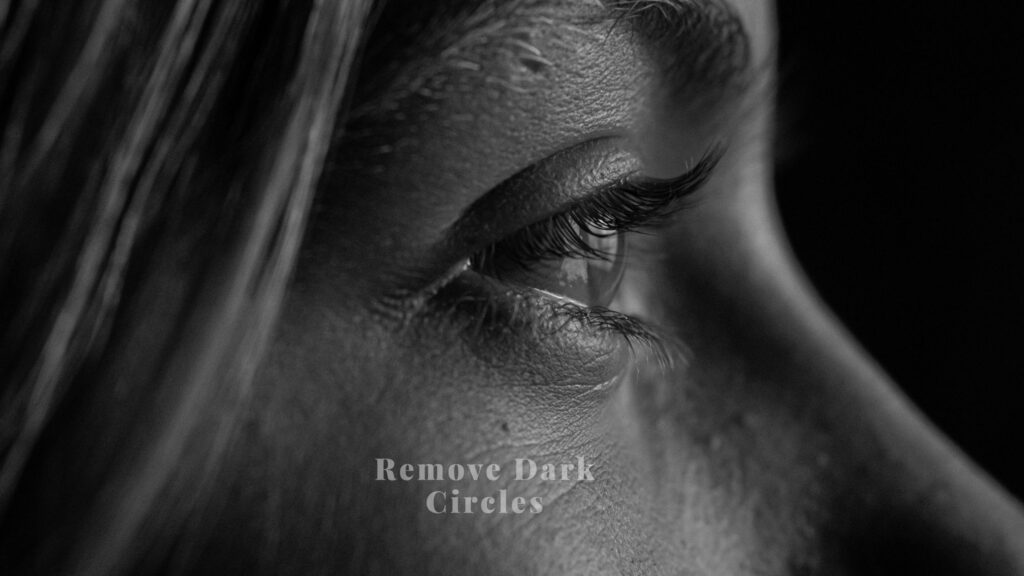 dark circles