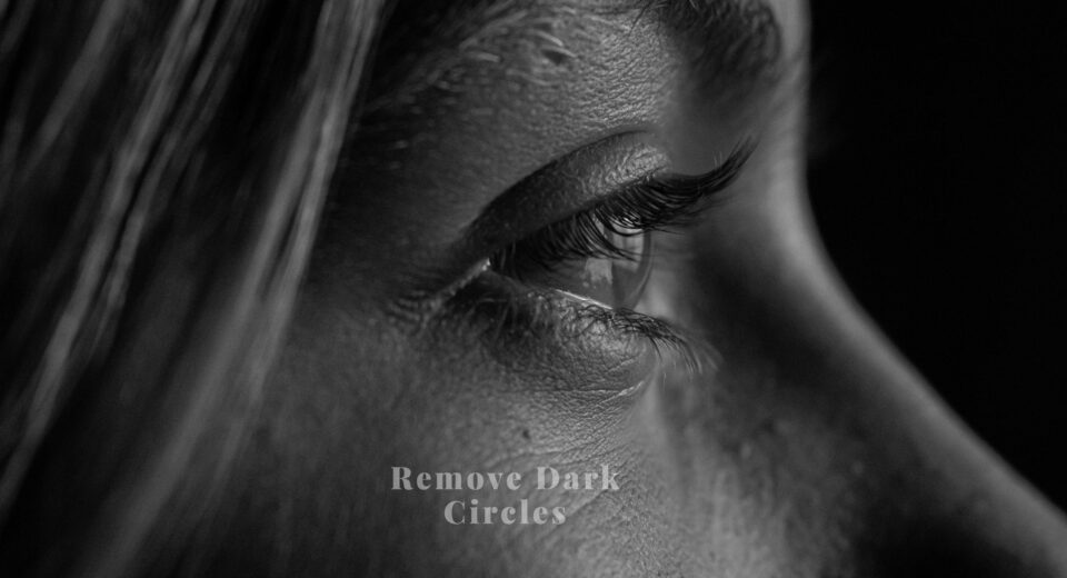 dark circles