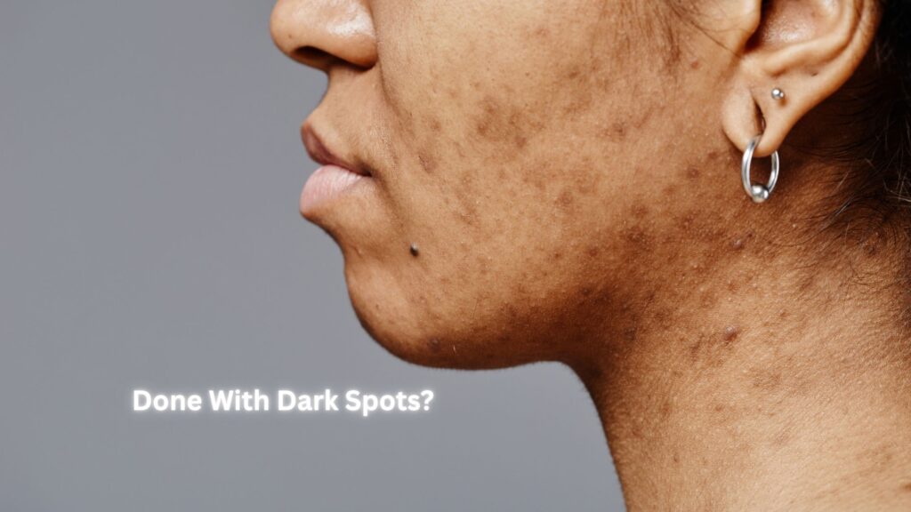 dark spots