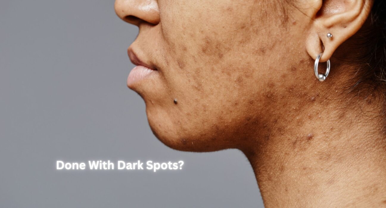 dark spots