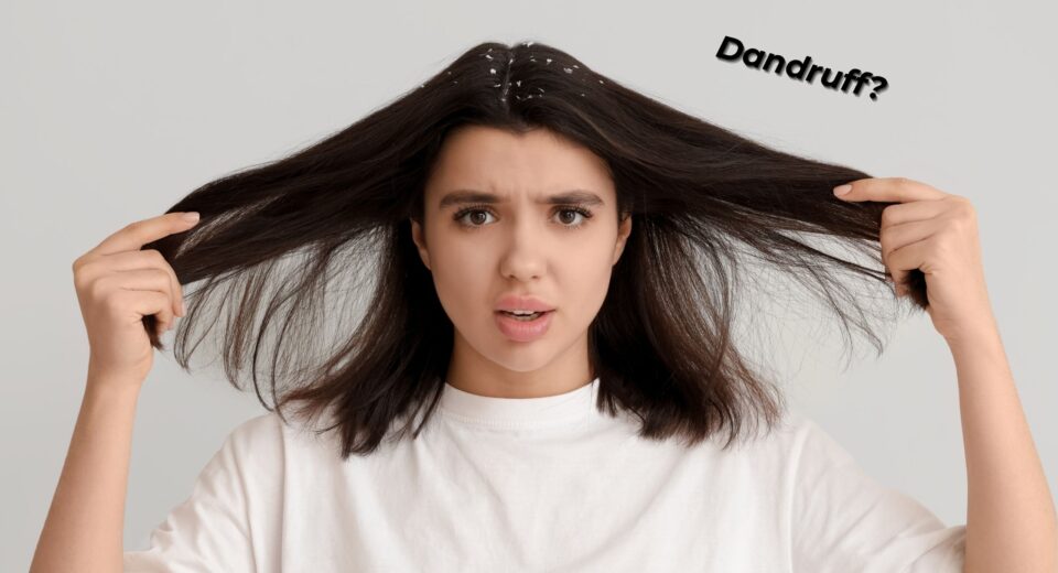Dandruff