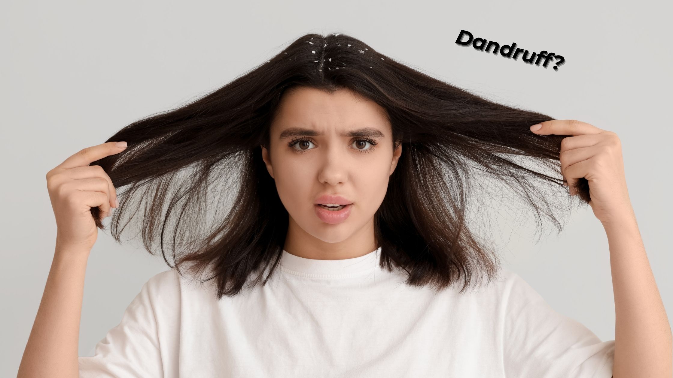 Dandruff